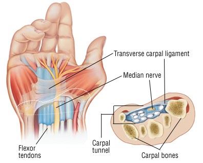 Fort Wayne  Carpal Tunnel Injuries After a Slip and Fall